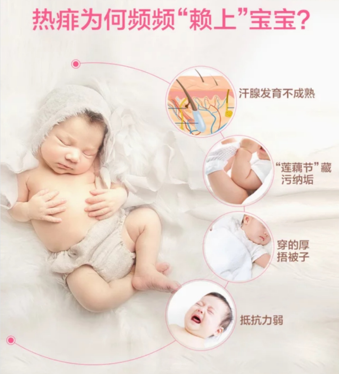 宝宝长热痱子的最佳治疗方法,宝宝长热痱子怎么快速下去