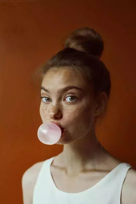 雀斑和痣斑的区别,雀斑样痣和雀斑的区别图片