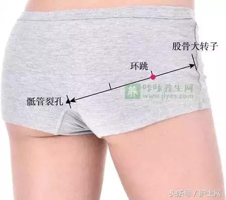 臀部疼痛位置移动是什么病,臀部疼痛要警惕四种病用什么药