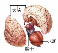 脑干梗塞发病怎么那么急,脑干梗塞发展期是怎么回事