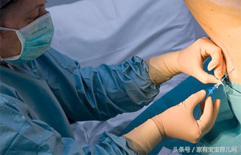 无痛分娩是什么感觉?生孩子就不疼了?我国只有10%产妇能享受