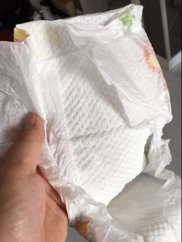 宝宝红屁屁和屁股湿疹区别,宝宝起湿疹跟纸尿裤有关系么