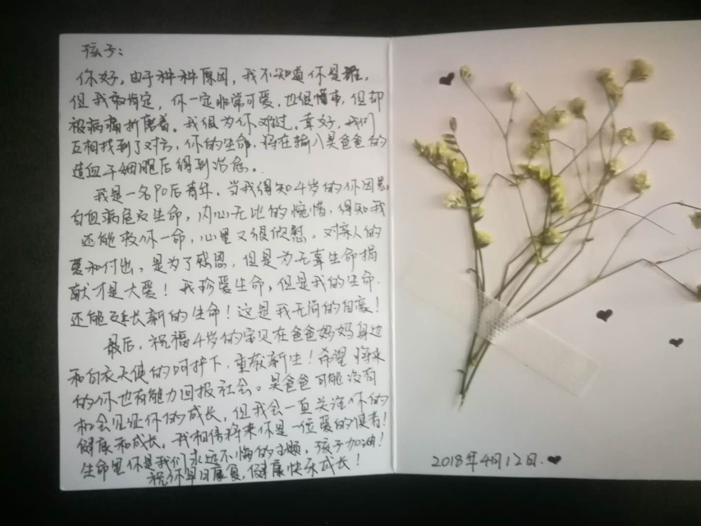 哈医大四院干细胞移植临床情况,哈医大一院干细胞微移植