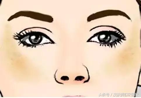 皮肤美容春夏秋冬护理方案,宋丽秋激光祛斑