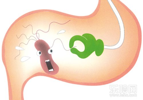 胃溃疡胃糜烂多长时间做一次胃镜,胃镜显示胃溃疡就是胃癌吗