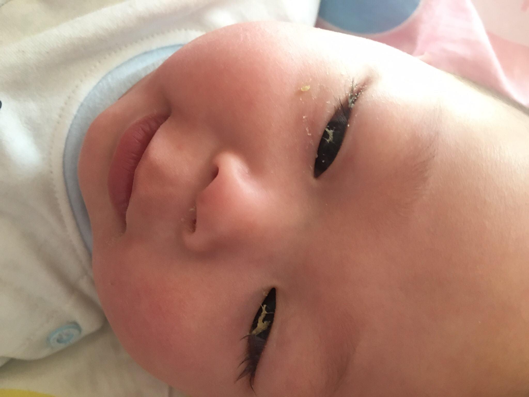 宝宝眼屎怎么清理是最好的方式,怎么正确的给宝宝清理眼屎