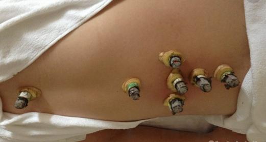 多囊月经不规律怎样发现怀孕,多囊调理后月经规律