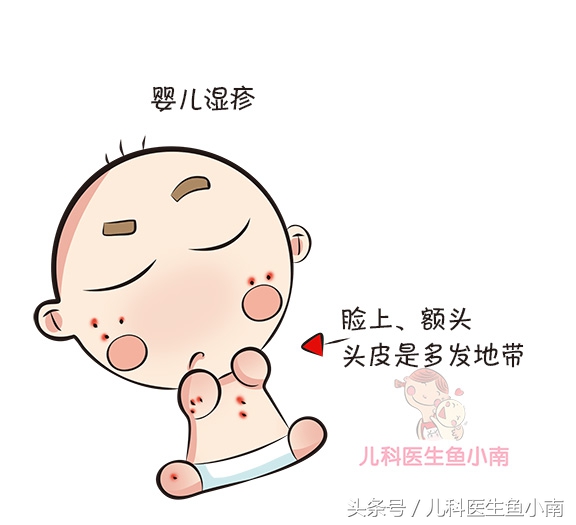 宝宝湿疹不红了但还有小疙瘩痒,宝宝湿疹和热疹的正确护理方法