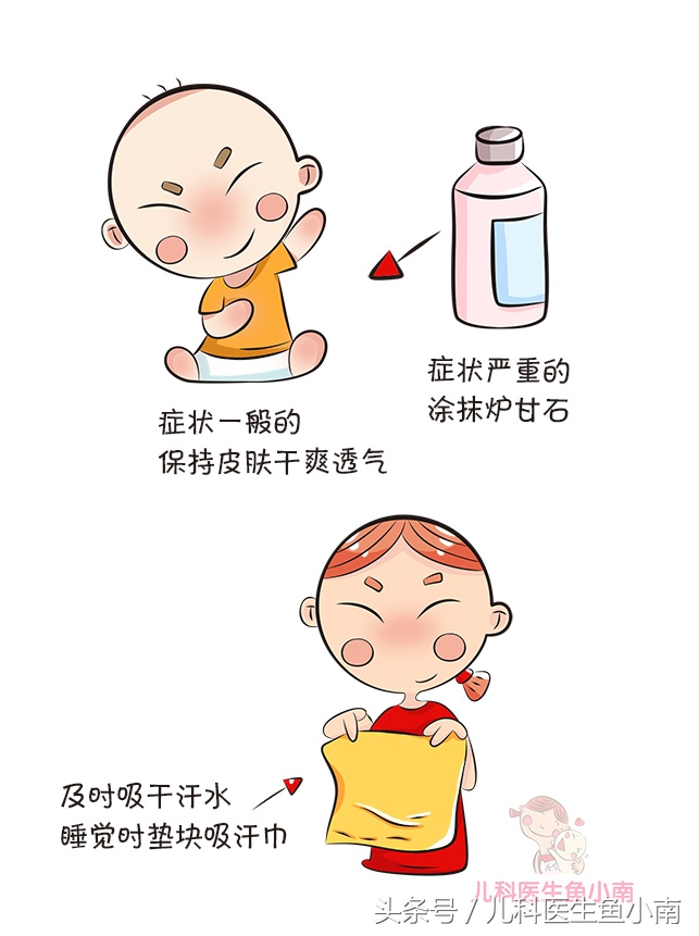 宝宝湿疹热疹区别,宝宝湿疹和热疹怎么观察