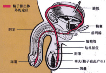你该知道的小姿势，关于不想意外要孩子的一些运动