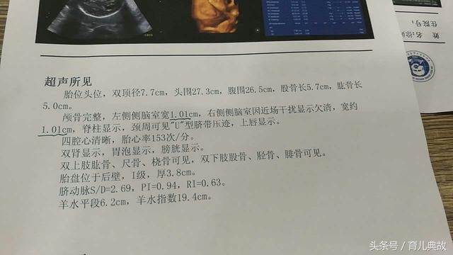 医生说胎儿侧脑室增宽,彩超提示脑室宽