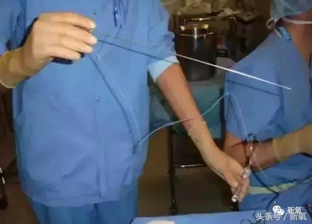 骗女生上床还买卖女生卵子，这些卖卵中介去死吧！