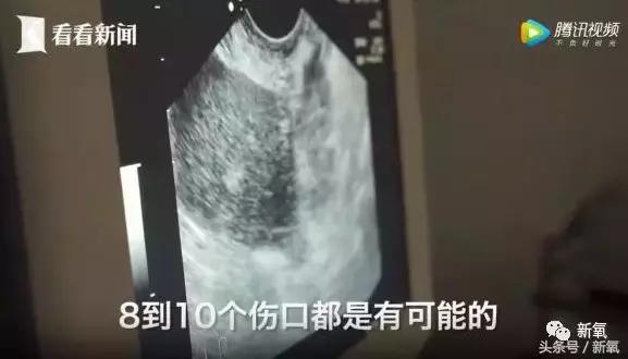 骗女生上床还买卖女生卵子，这些卖卵中介去死吧！