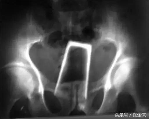 不可思议奇怪的东西,不可思议小物件穿透