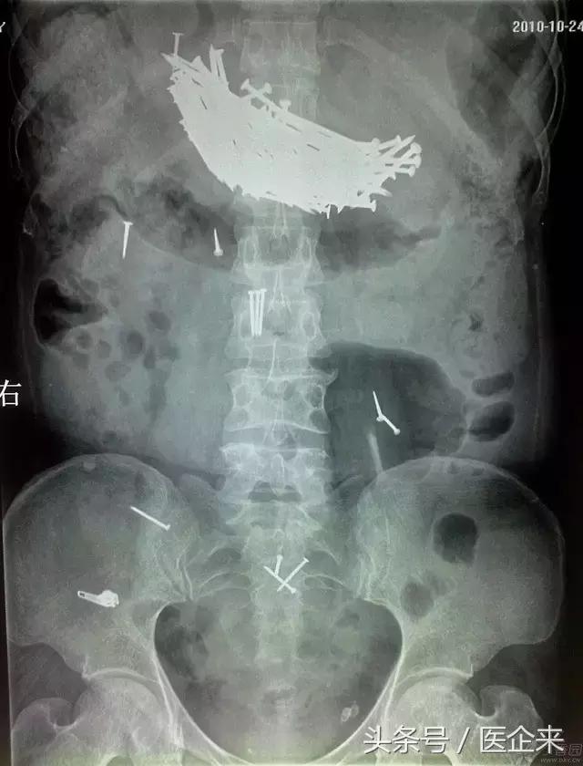 不可思议奇怪的东西,不可思议小物件穿透