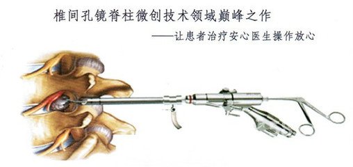 椎间盘突出症术后还会复发吗？