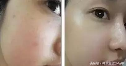 深度剖析医美整形的危害,医美整形该如何避坑呢