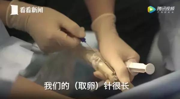 女大学生捐卵案完整,女大学生捐29个卵