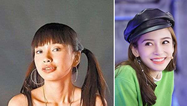 阿娇整牙,阿娇整牙前后对比