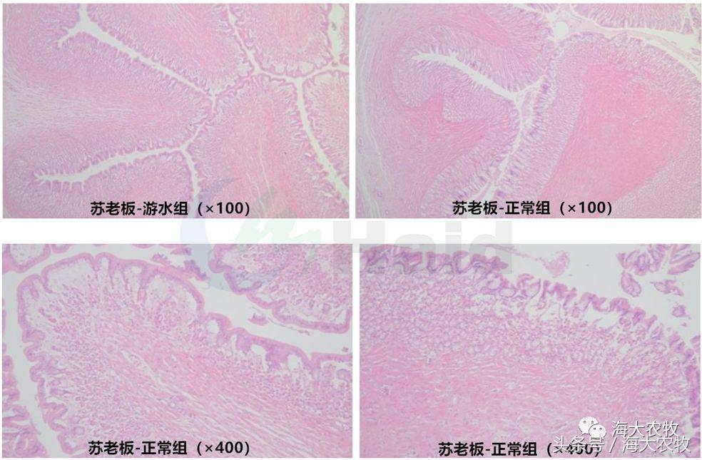 显微镜效果,显微镜对医学检验的推动作用