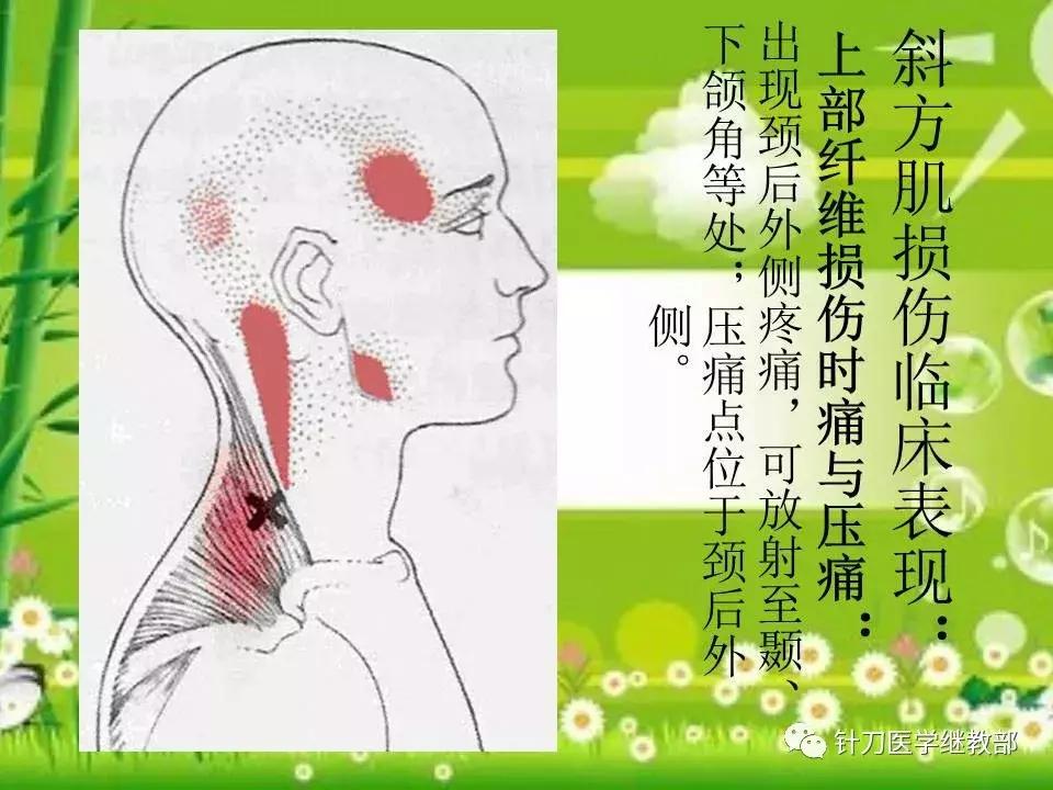 颈椎肌肉损伤用小针刀治疗,针刀治疗颈椎导致神经损伤