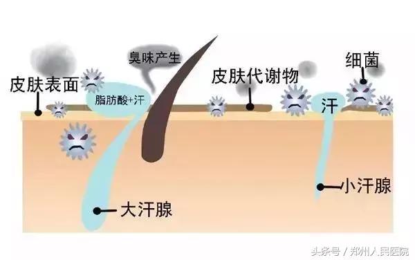现在腋臭的最佳治疗方法,怎么能消除腋臭的窍门