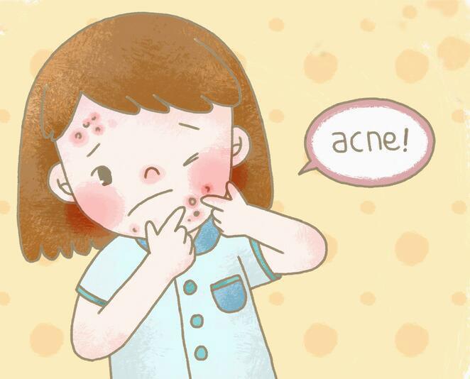 异维a酸是抗痘神器吗,战痘终结者异维a酸