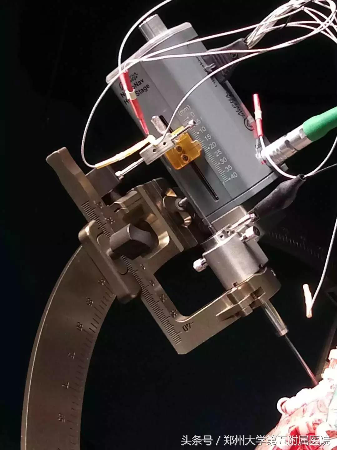 郑州大学第一附属医院治疗帕金森,郑州大学五附院脑梗康复治疗