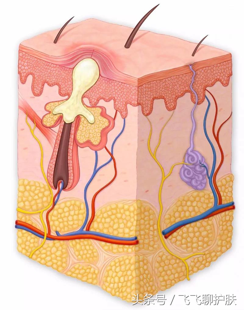 大概只有自己最清楚为什么长痘,各种痘痘类型都是如何产生的