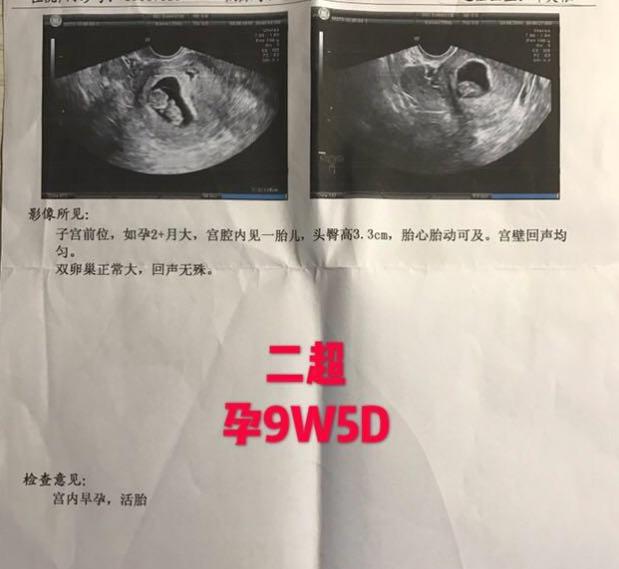 备孕:经历了翻倍乌龙后,我的经验小结