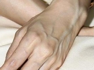 手上青筋怎么根治,可以看到手上的青筋是怎么回事