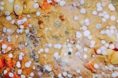 美国癌症协会公布九大防癌建议 (美国癌症协会公布9大防癌建议)