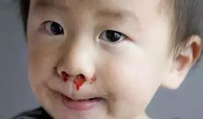 意外伤害急救的正确做法,幼儿园意外伤害应急培训记录