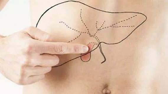 以为是肠胃小毛病没想到是癌症,开始以为是胃疼后来才发现是结石