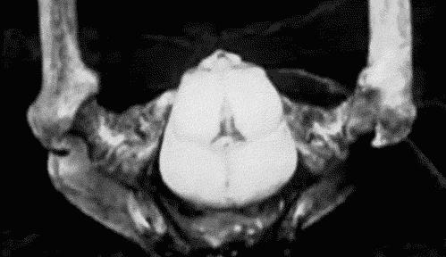 大姨妈的实质是什么,大姨妈进化过程