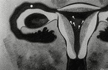 大姨妈的实质是什么,大姨妈进化过程