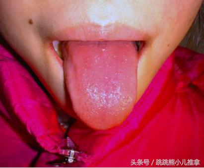 怎么看宝宝舌头是否积食,宝宝积食的舌头是怎样的