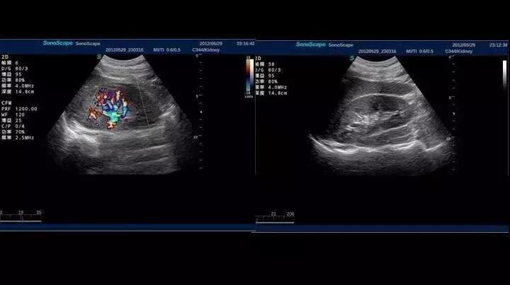 超声检查常识,那些你不知道的检查