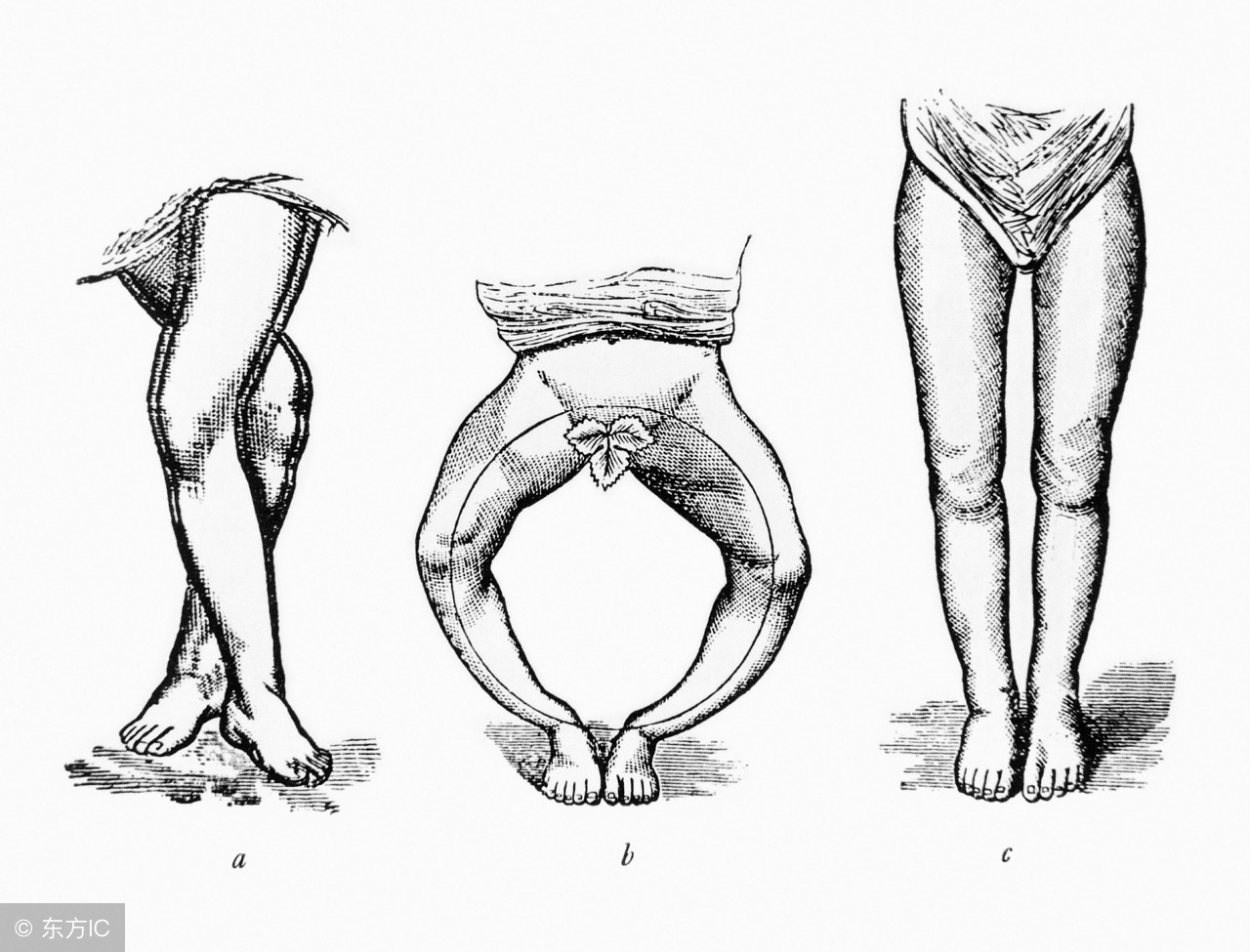 警惕!早产儿会有很多并发症的可能!如何避免?