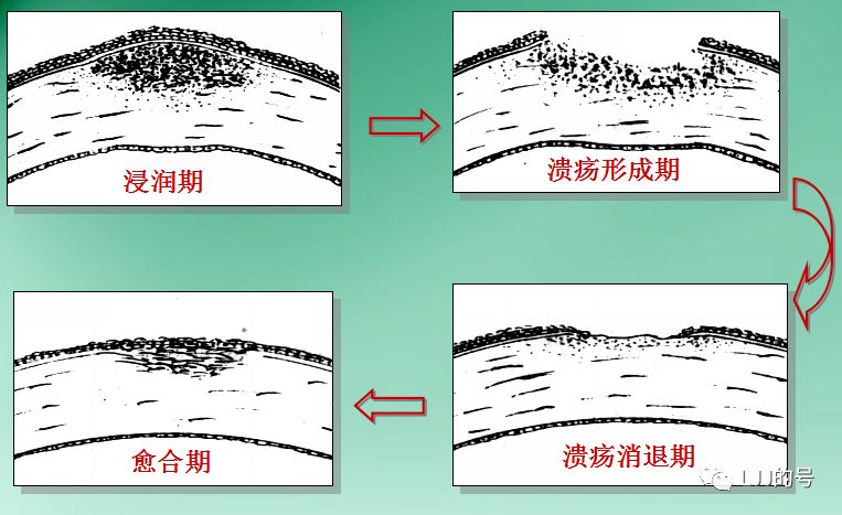 爱眼护眼保护眼睛的科普小视频,6月6日全国爱眼日护眼从小事做起
