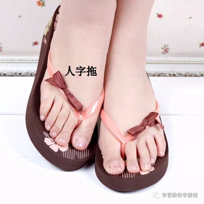 拇外翻该怎么办,拇外翻的解决方法