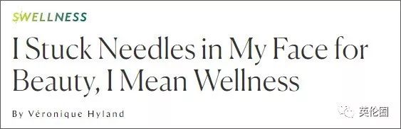 哈里梅根婚前求助中医！歪果仁已经把针灸吹上了天