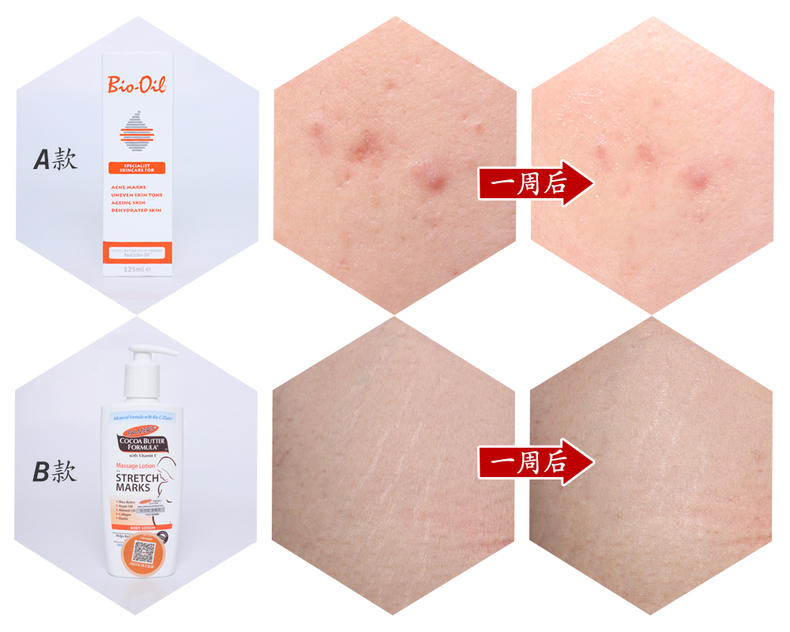 无添加孕产妇月子专用油,漂亮妈妈产后测评