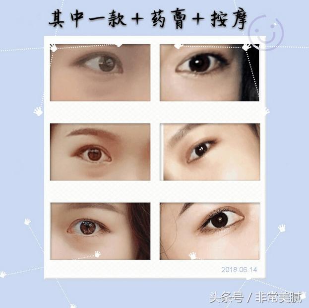 学生党眼霜推荐平价拼多多,淡化黑眼圈眼霜推荐学生党平价