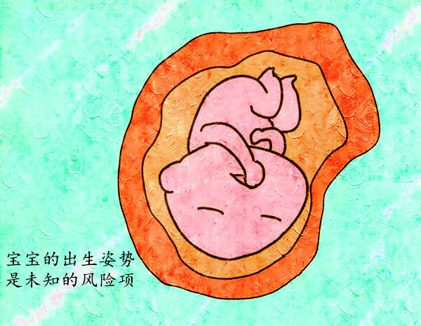 为何生产时要侧切,分娩一般啥情况需要侧切