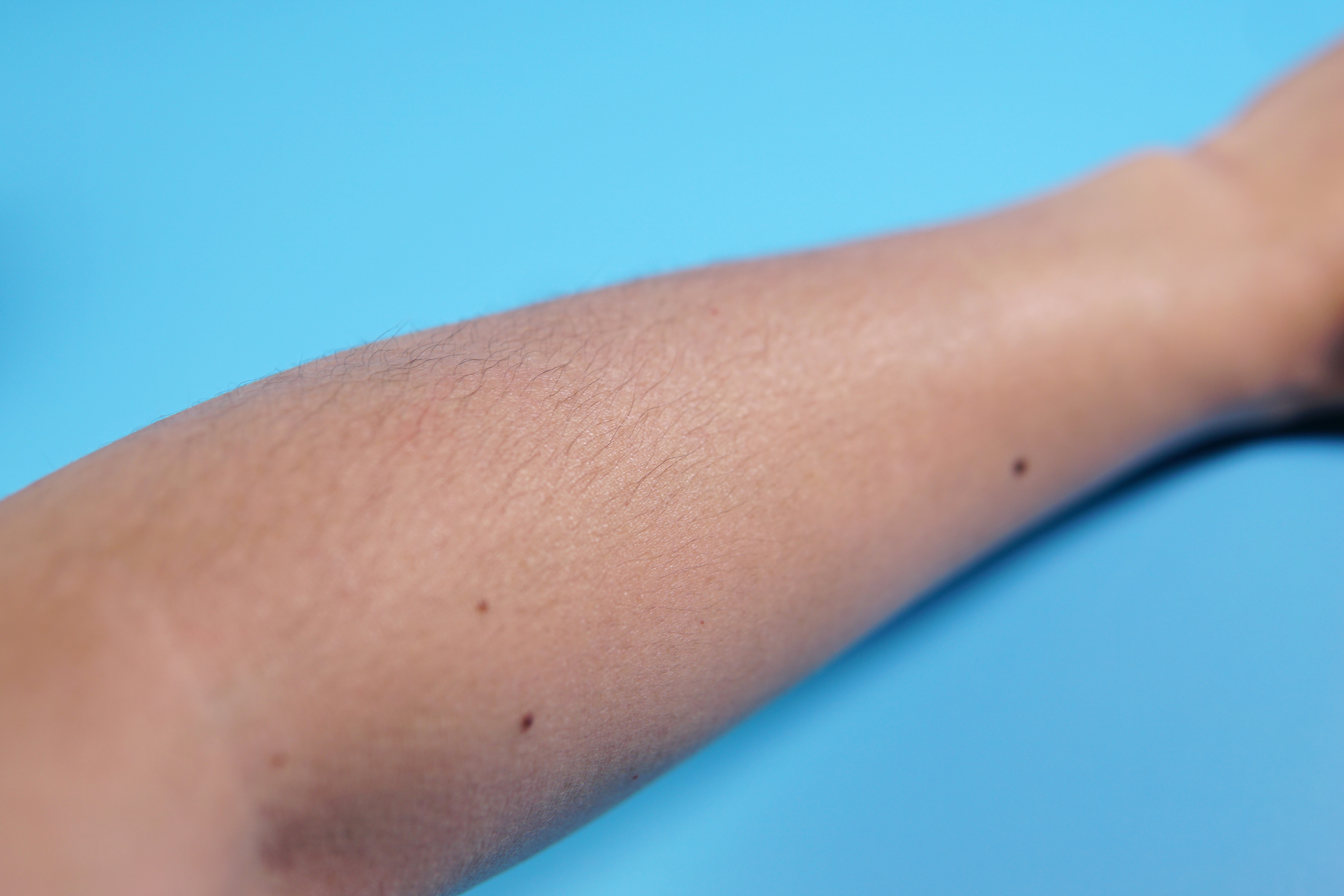 少花冤枉钱认准好产品,射频美容仪拔草还是种草