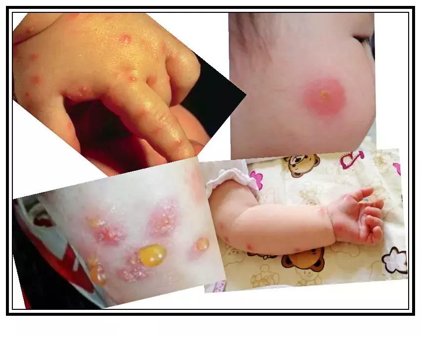 与宝宝并肩作战的每个夏天！