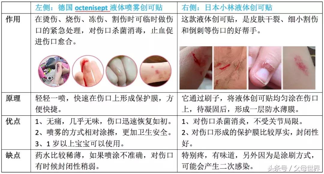 宝宝受伤用什么创可贴,宝宝受伤可以用创口贴吗