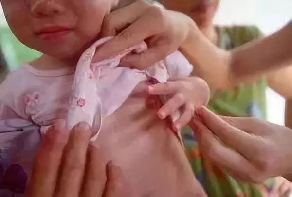 女孩才两岁就乳房发育、阴道出血？镇江人小心家里的这种东西……