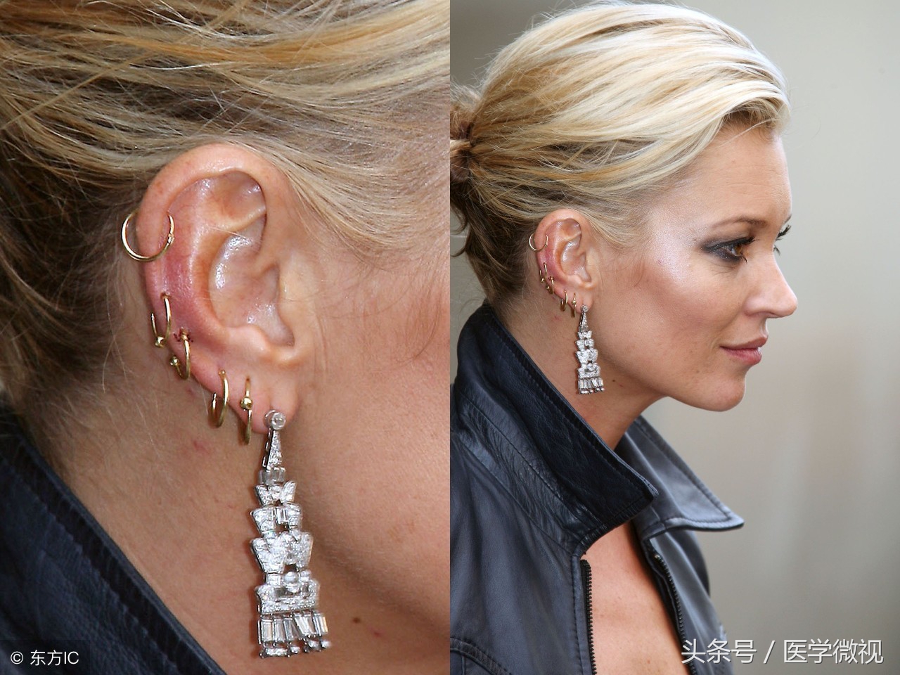 从中医怎么看待“打耳洞能起到明目的作用”？